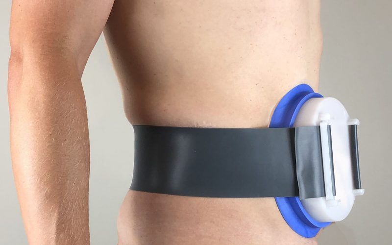 Tips to Help You Avoid Ostomy Bag Leakage